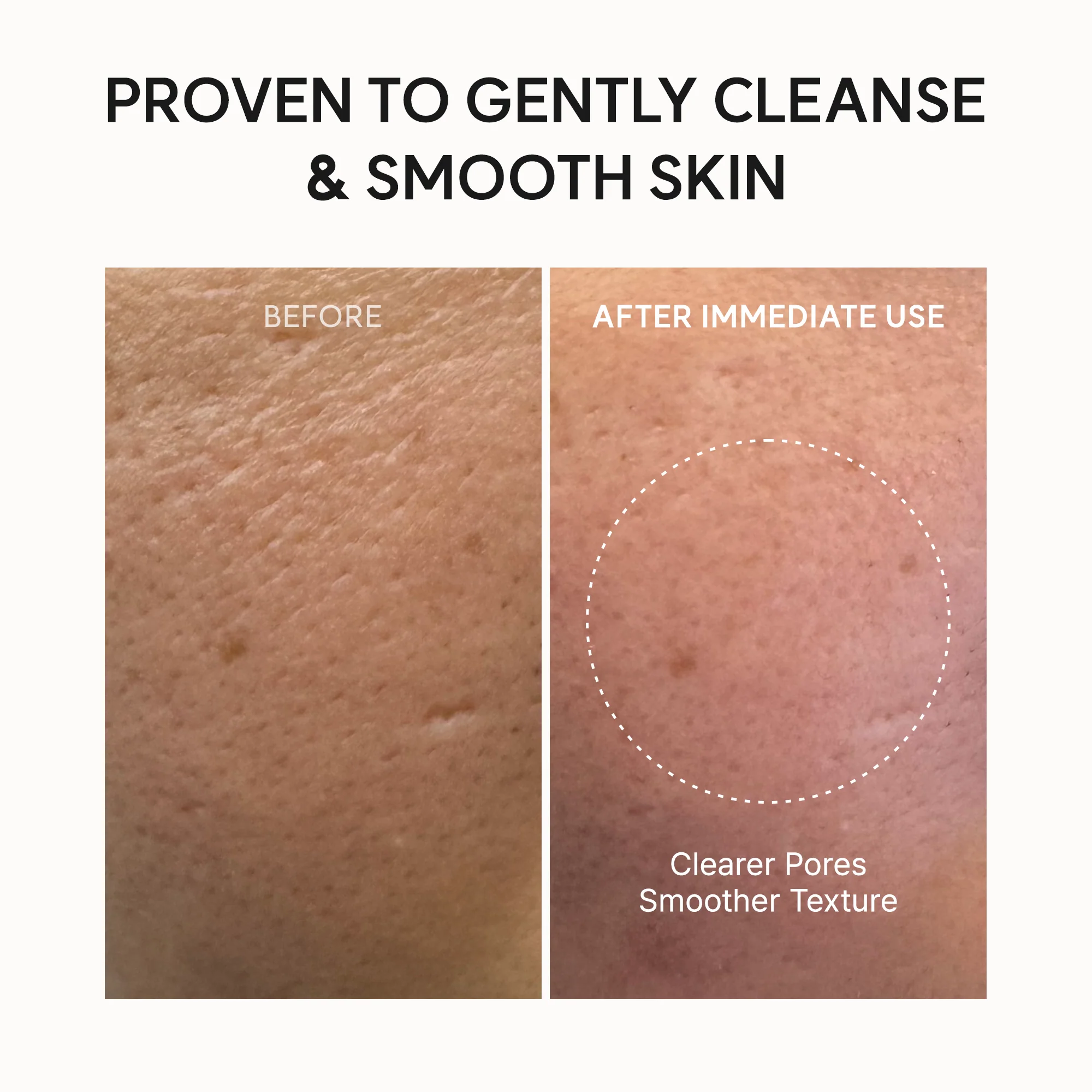Arencia Fresh Rosehip Mochi Cleanser - Image 7