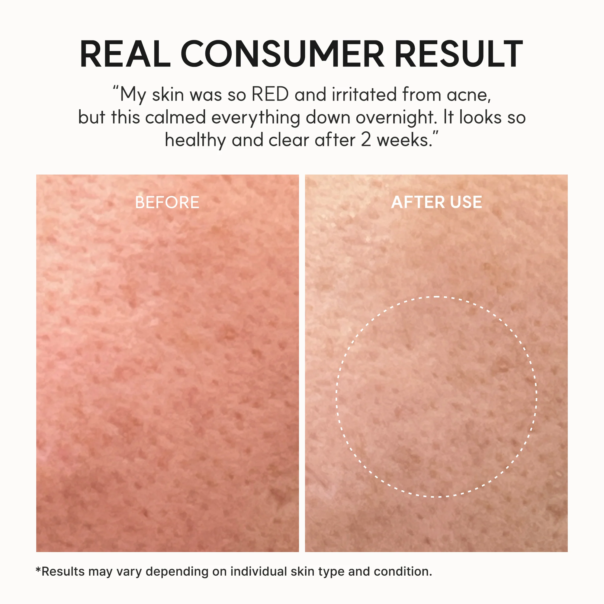 Eraser Soothing Cream, Lightweight Barrier Moisturizer with Centella & Ceramide NP for Hydration & Calm-Looking Skin, 1.69 fl. oz. - Image 7
