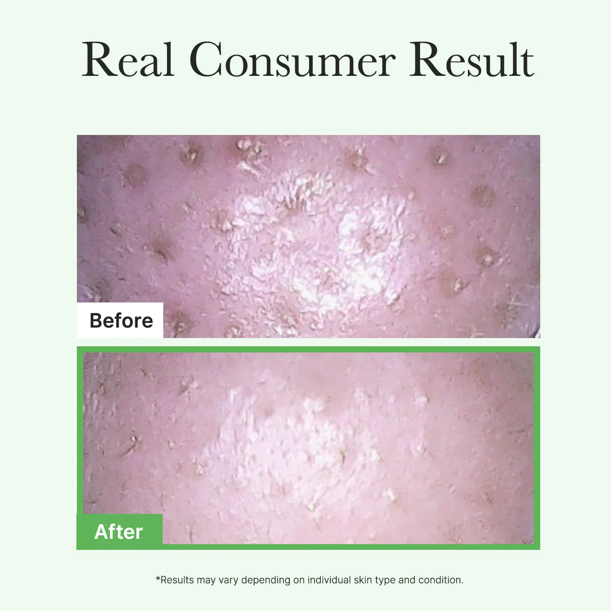 Pore Melt Mochi  Makeup-Removing Cleansing Oil, Non-Comedogenic, Acne-Safe, Rice Amino Acids HD, Vitamin E, Cica, & Ceramide, 6.76 fl oz - Image 7