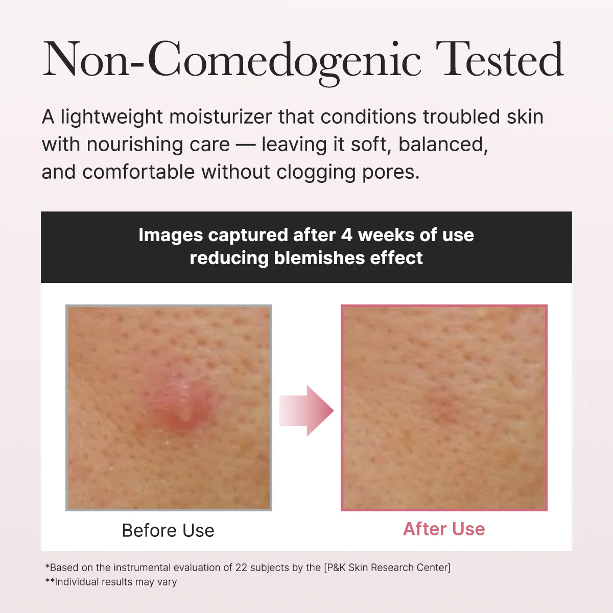Red Smoothie Face Lotion Moisturizer 5, Niacinamide 5% & Collagen for daily bouncy, glowy skin care - Image 4