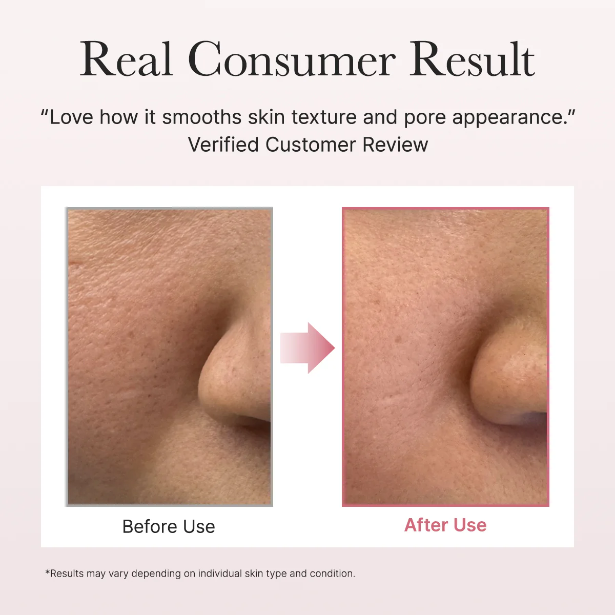 Red Smoothie Face Lotion Moisturizer 5, Niacinamide 5% & Collagen for daily bouncy, glowy skin care - Image 8