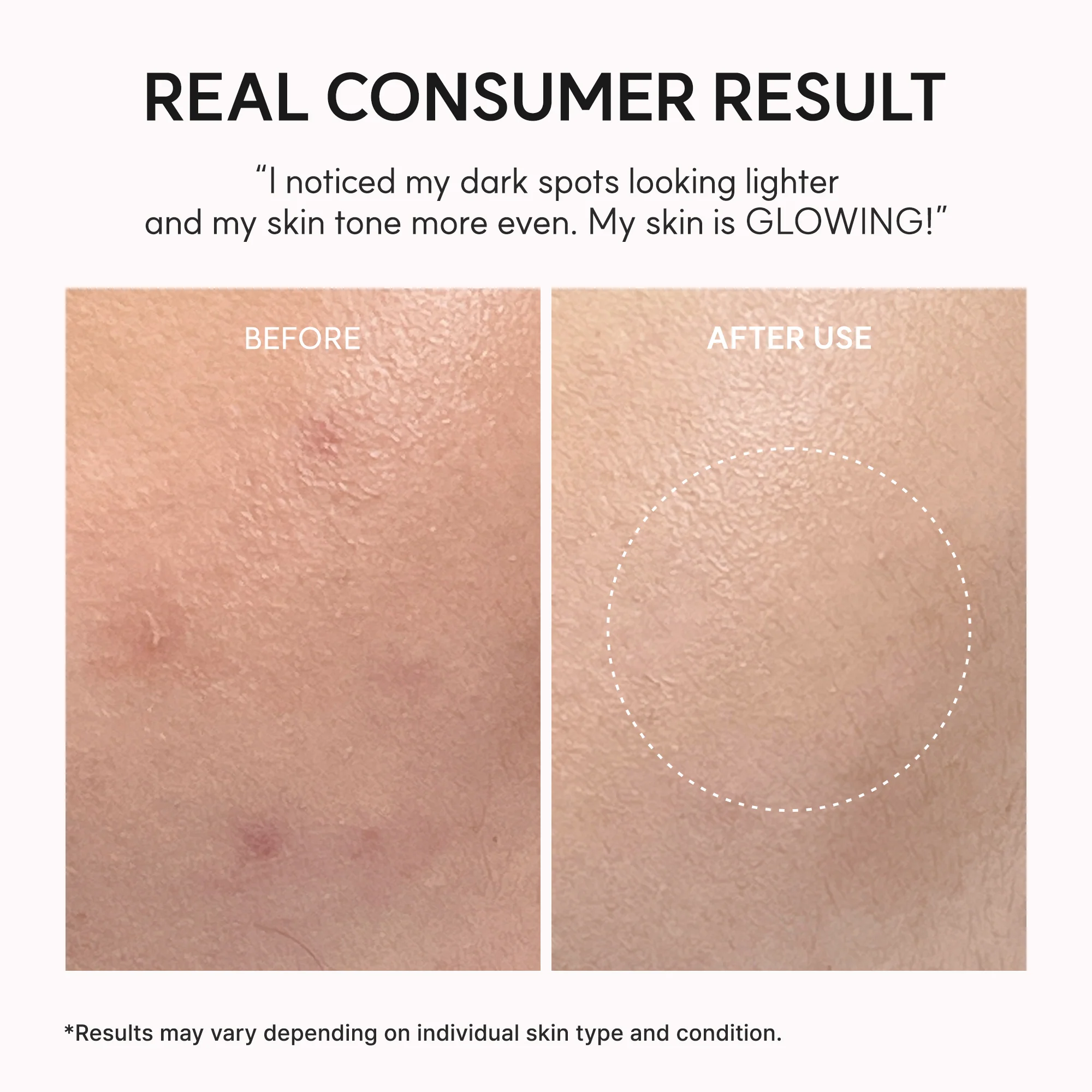 TXA Booster Shot, Intensive Dark Spot Correcting Serum with 5% TXA, Niacinamide & 10 Peptides for Visible Tone Correction & Radiant-Looking Skin, 1.01 fl. oz. - Image 6